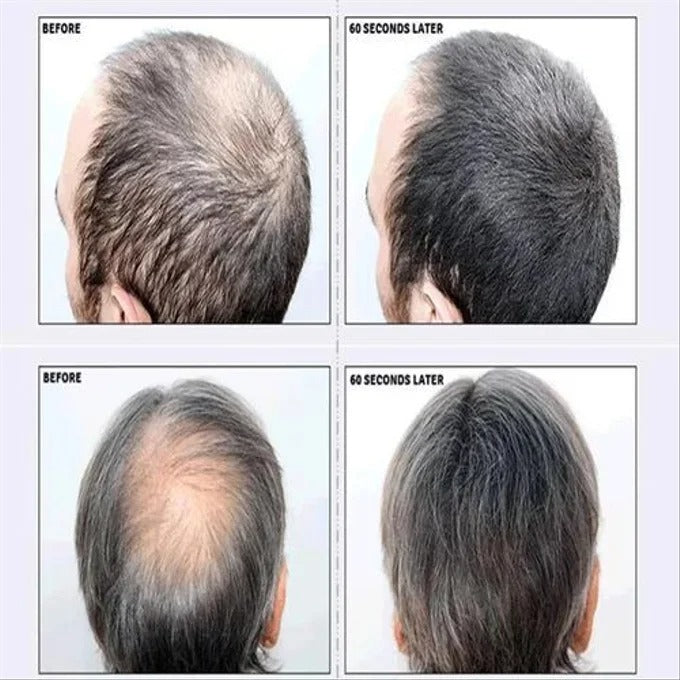 Toppik Fibres Capillaires