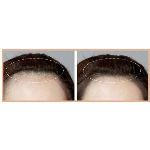 Stylo Correcteur Cheveux